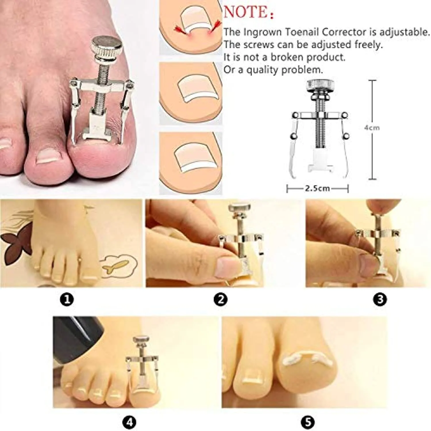 JTIEO Ingrown Toenail Tool Pedicure Tools (9PCS) Ingrown Toenail Treatment Toenail Clippers Professional Tool Set for Ingrown & Thick Nail Stainless Steel Ingrown Toenail Tool